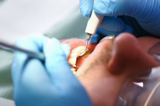 Best Emergency Denture Repair in Oakboro, NC